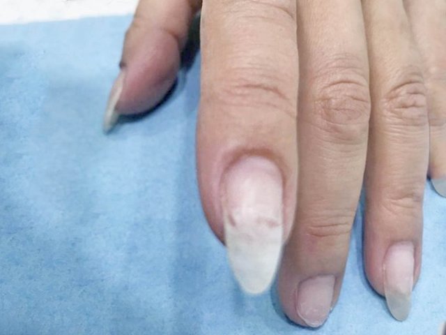 ネイリストがおしえる、爪の割れたときの応急処置の方法