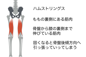 骨盤を後ろ側にひっぱる筋肉として、太もも裏の筋肉である「ハムストリングス」があります。この筋肉が硬いと骨盤を後ろ側に引っ張り骨盤後傾になってしまいます