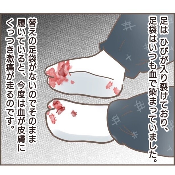 養母からのイジメで足袋は血で染まり……。冬に暖を取ることも許されず、こたつに足を入れようとすると蹴られて