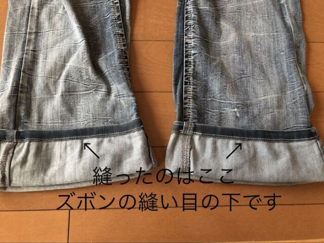 両足縫えました