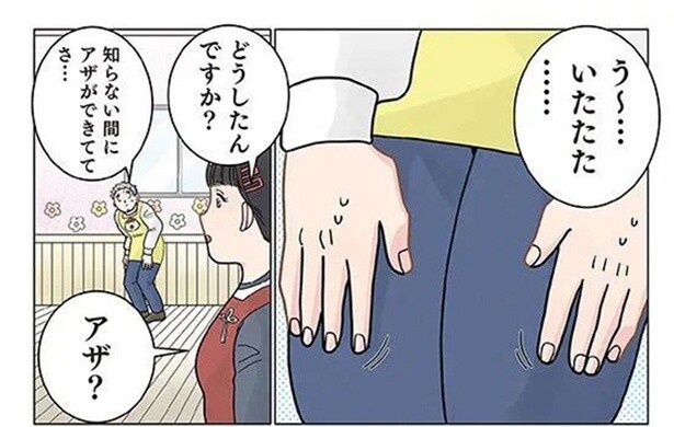 らない間に保育士の太ももにアザが！ 翌日判明した「原因」は？