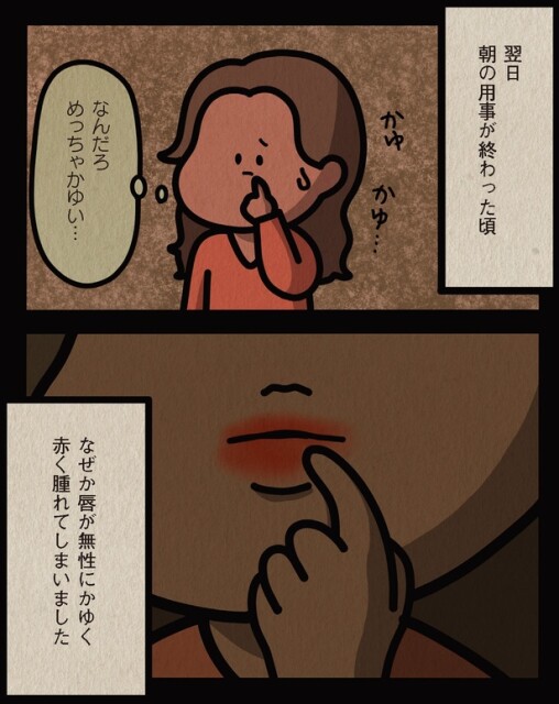 唇が無性にかゆく赤く腫れてしまいました