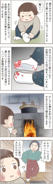 足はひびが入り裂けており
