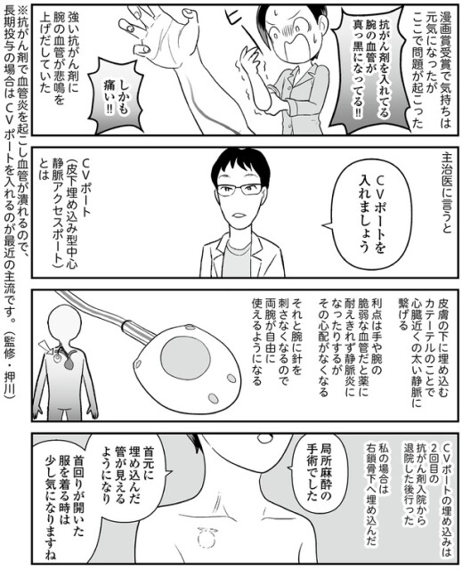 CVポートを入れましょう