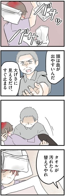 頭は血が出やすいんだ