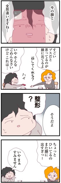 整形？