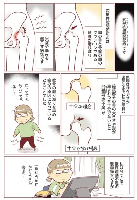 変形性股関節症