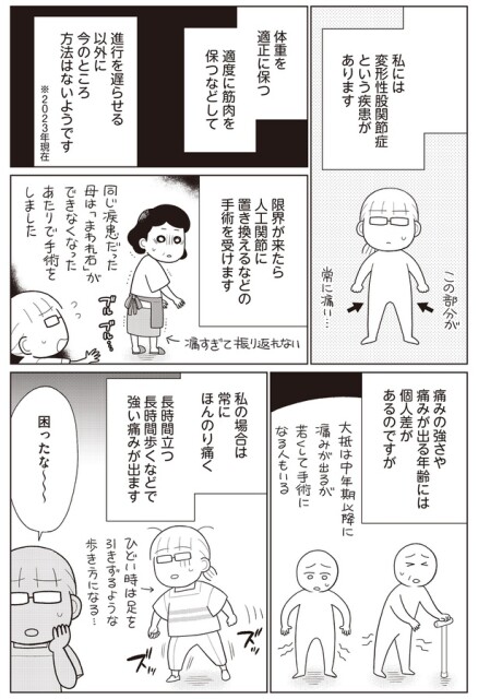 変形性股関節症という疾患