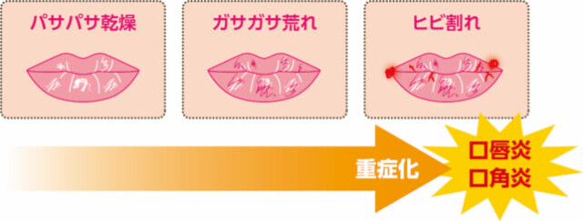 唇ケアの新常識！今年からすべきリップマッサージ