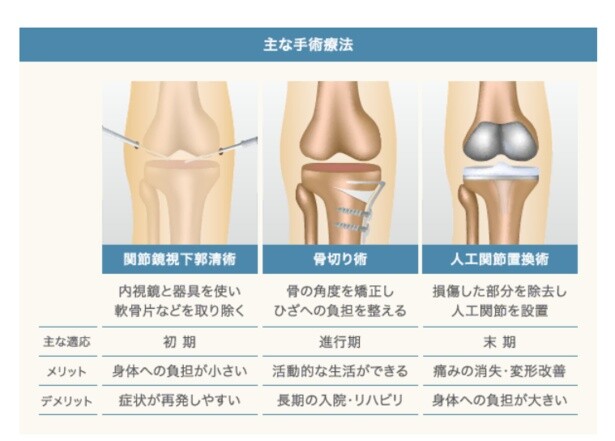 手術にもいくつか種類があり、症状や進行度に応じて選択する