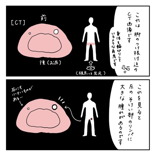 第14話4-1