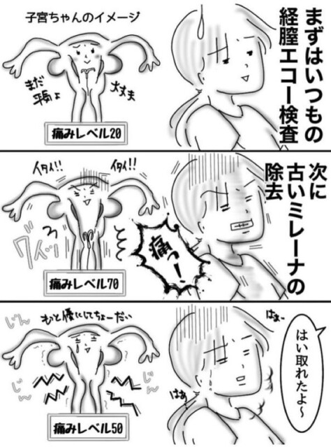 ミレーナ02