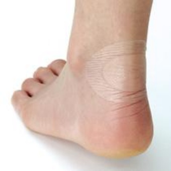 靴擦れ絆創膏おすすめ5選!痛みを和らげる必携アイテム