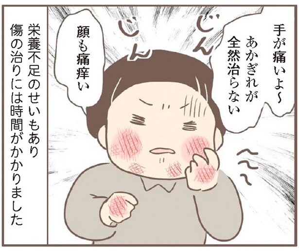 過酷な家事労働で体はあかぎれだらけ。いじわるな養母はこたつにも入れさせず…