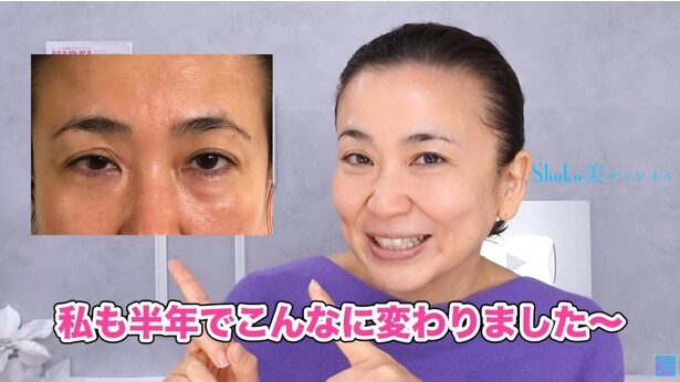 「目の下のたるみ」が気になる人へ。人気美容YouTuberが教える7分間ストレッチ【50代ビフォアフ】