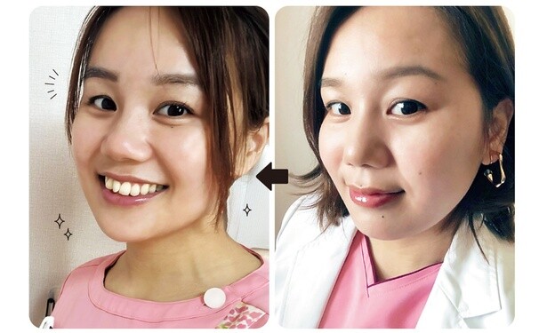 寝起きの顔がむくんでパンパン...ツボ押しで「むくみ顔」や「二重あご」にさようなら