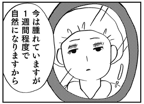 「整形しないと幸せになれないから」高校入学前に行った二重整形／親に整形させられた私が母になる（1）