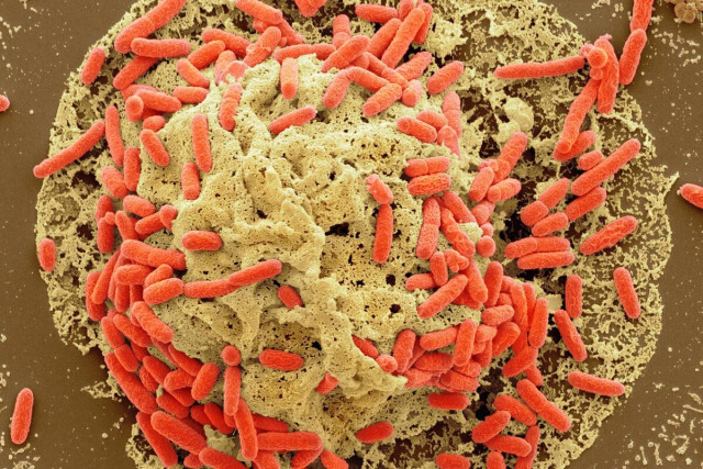 急増する若い世代の大腸がん、子供の頃の腸内細菌が関連か、研究
