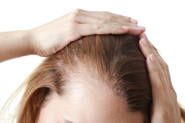 寂しい髪の原因は◯◯不足？豊かな髪を保つためのケア方法