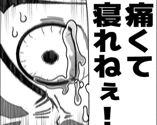 【漫画】動かすだけで肩に激烈な痛みが！辛すぎて涙…これ「漫画通りで共感しかない！」こんなにも仲間が!?日本中に石灰保有経験者が多数!?