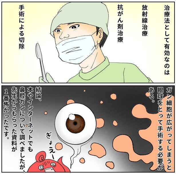 【漫画】鼻のがんが転移すれば眼球摘出の可能性も!?精密検査で知ったお医者さんの話が怖い…