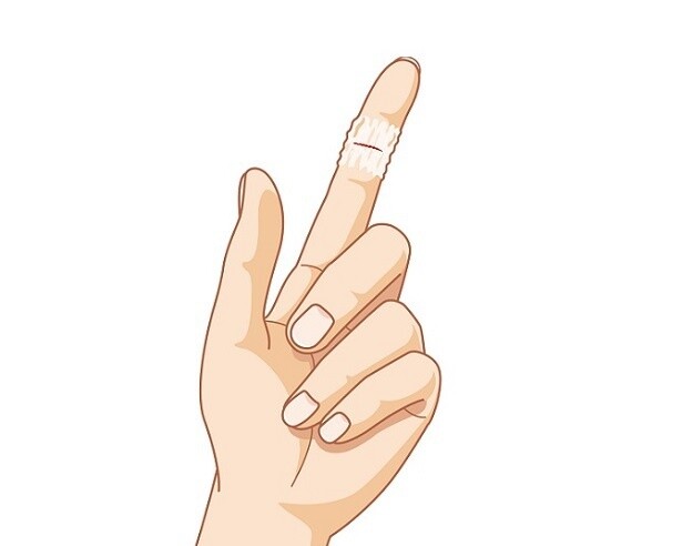 「キズを早くきれいに治したい!!」絆創膏の選び方と正しい使い方とは？【専門家が解説】