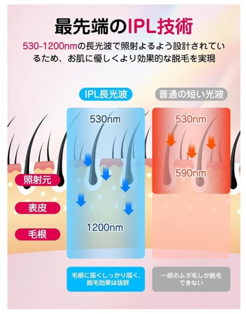 99万発の照射回数！家族みんなで使えるIPL光脱毛器【ウォンセフー】のメンズ脱毛器がAmazonに登場!