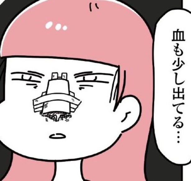 「ブス」と言われ700万以上かけて整形！時間が経つとまた「気になる」欲求は果てしない、整形沼から抜け出すまで【著者に聞く】