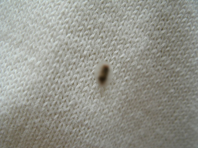 毛玉と見間違えに注意!?　冬服をしまう前の害虫対策